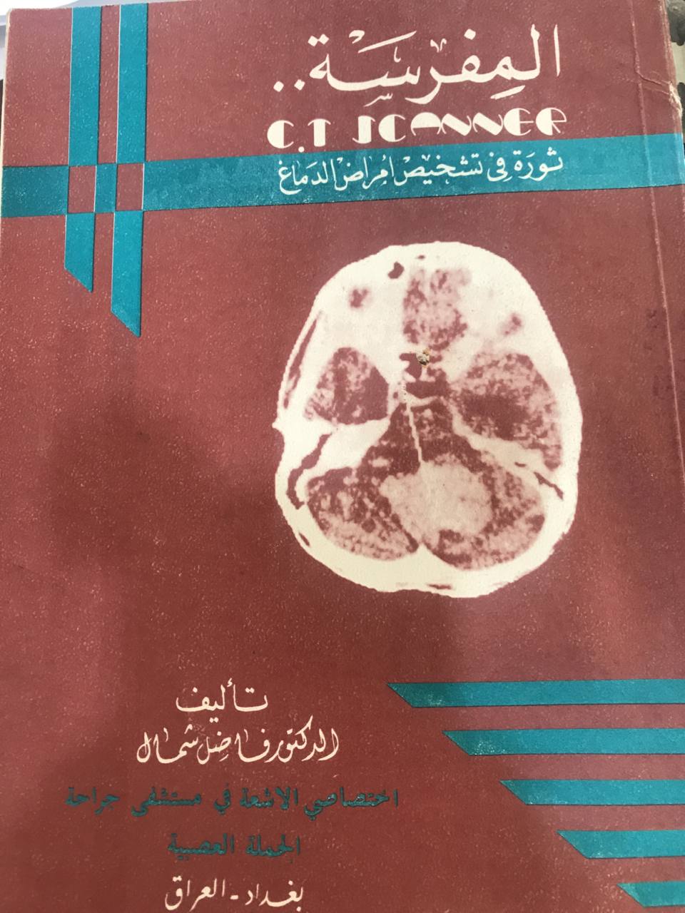 المفرسة ثورة في تشخيص امراض الدماغ